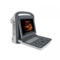 Chison ECO2 Ultrasound