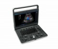 SonoScape E2 Ultrasound